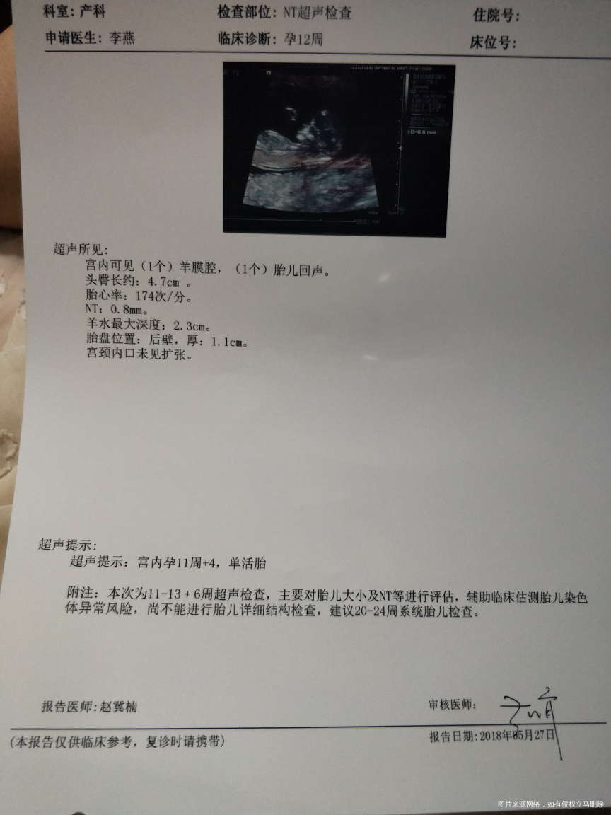 十一周NT检查一切正常吗