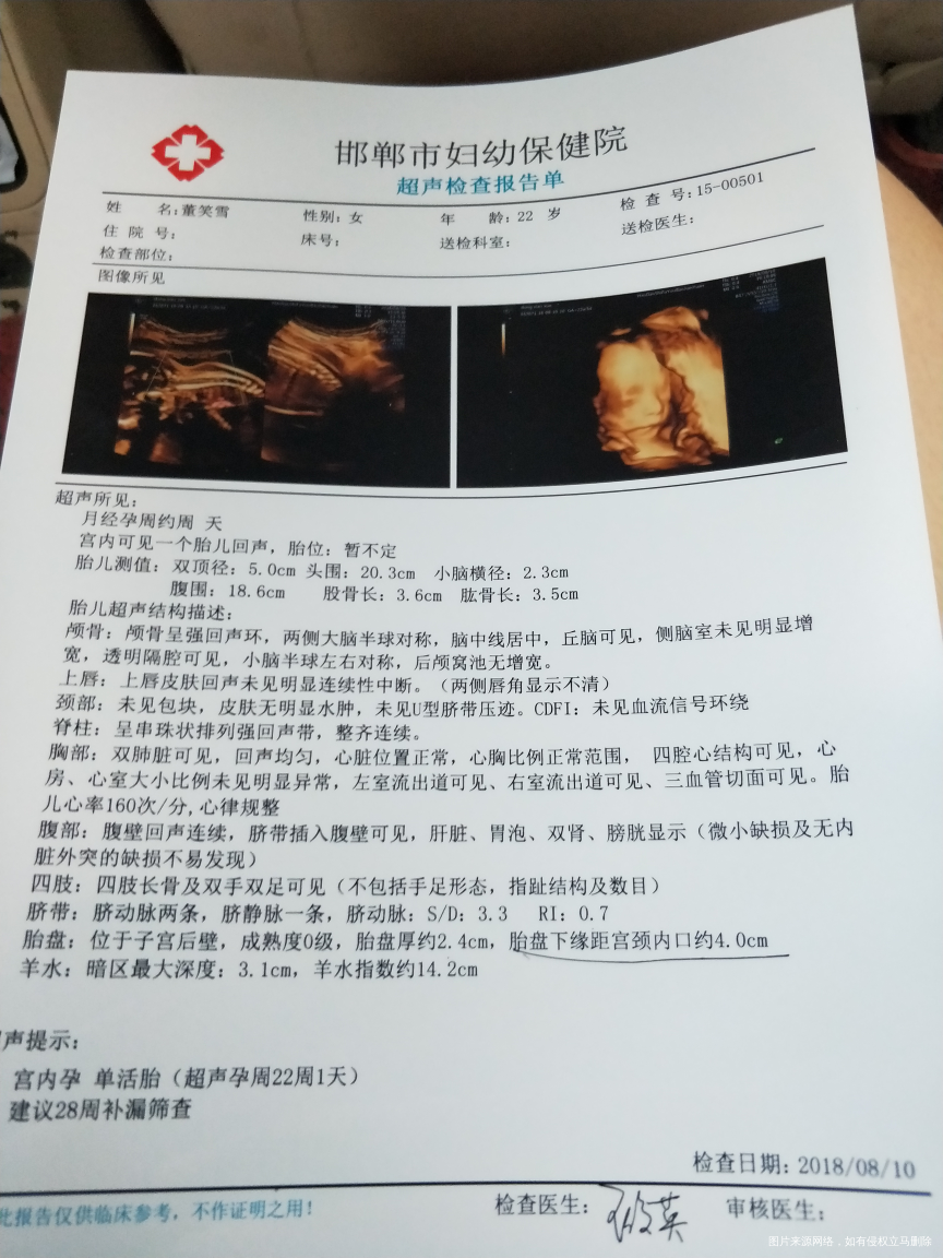 医生帮忙看看大排畸单子