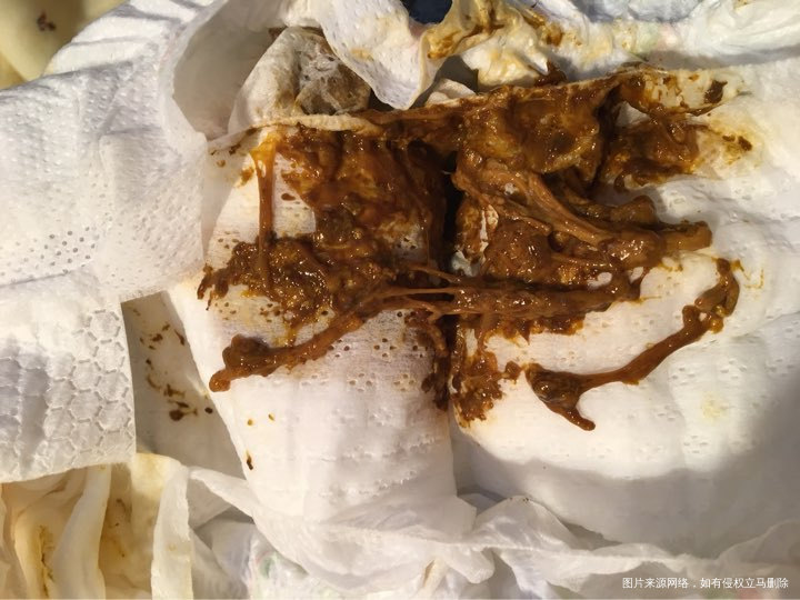 初生28天婴儿大便请老师看看