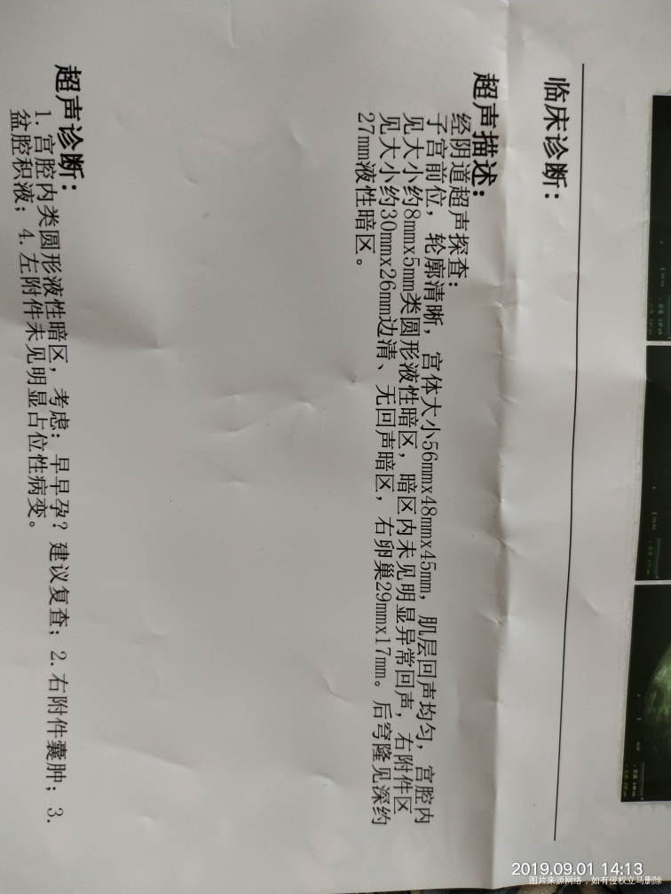 我的末次七月十四号,早孕测的是阳性,昨天