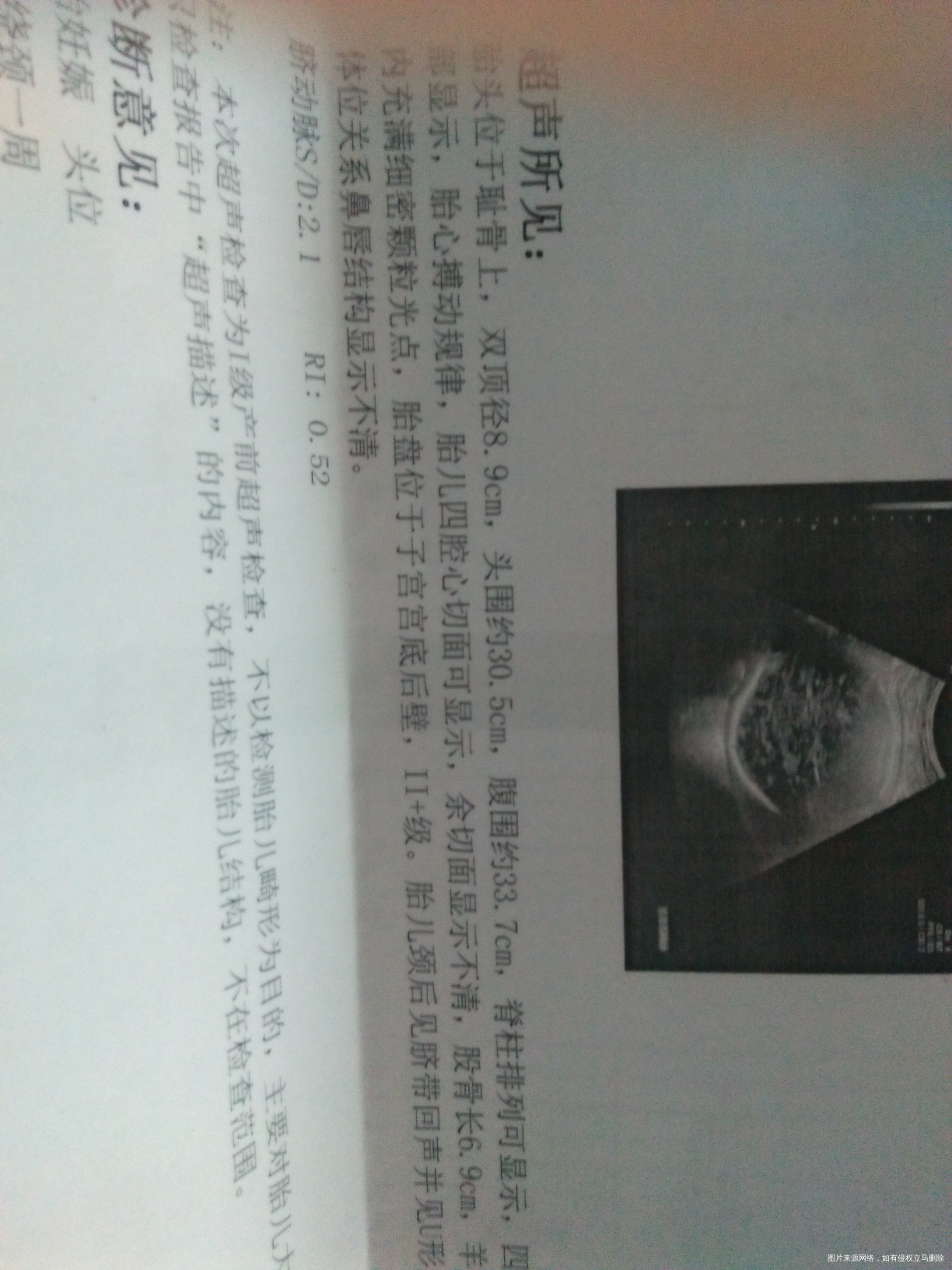 昨天做的检查,医生帮忙看看正常吗看看有多重了?