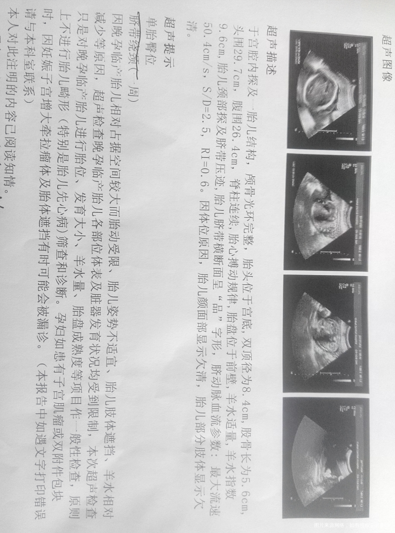 麻烦在线医生给看一下超声报告单!