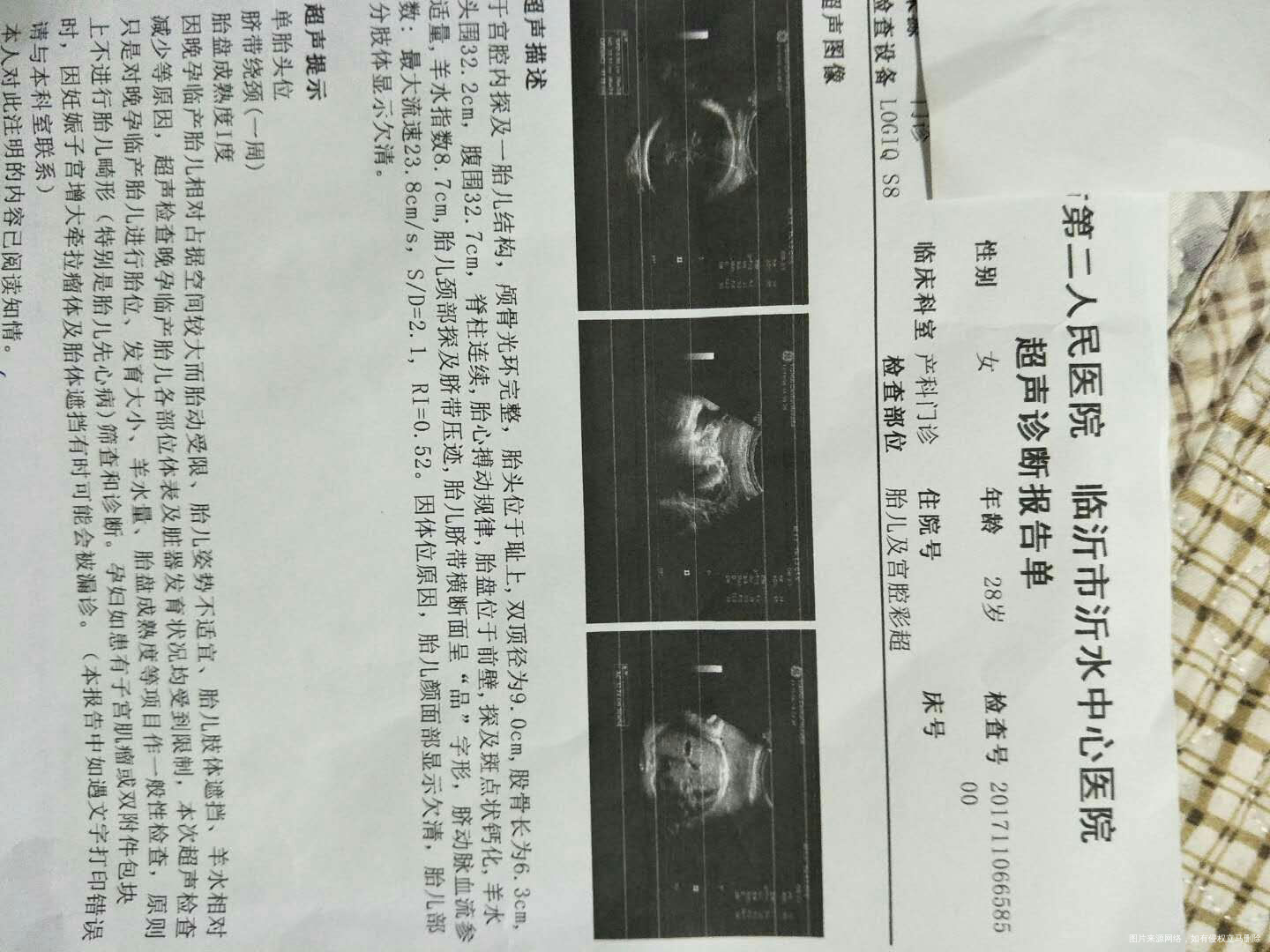 麻烦医生给看一下报告单!