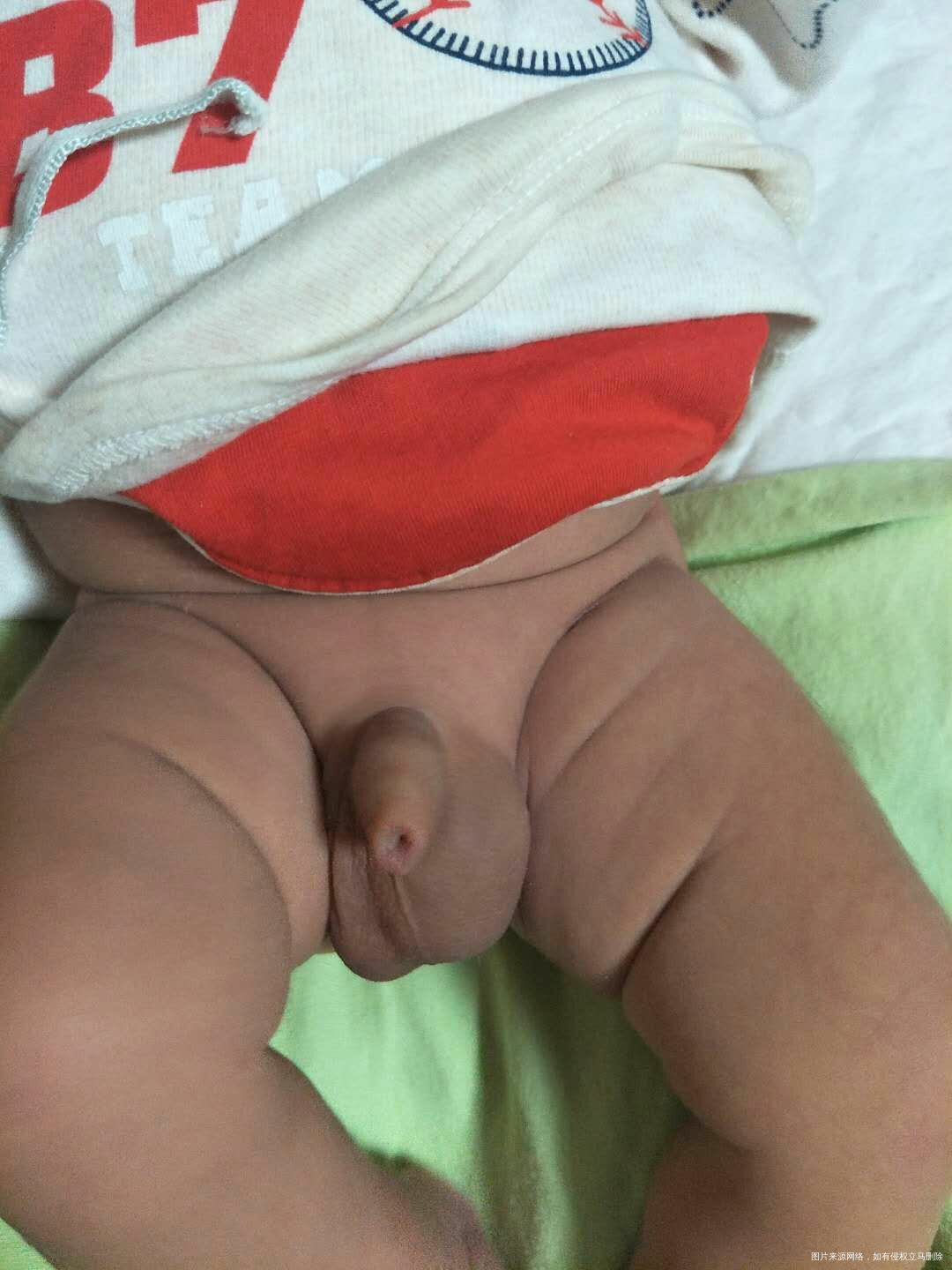 麻烦医生给看一下男宝宝出生一个月