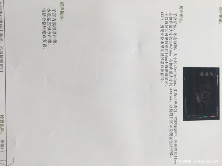 医生帮忙看看好吗,搞不懂了