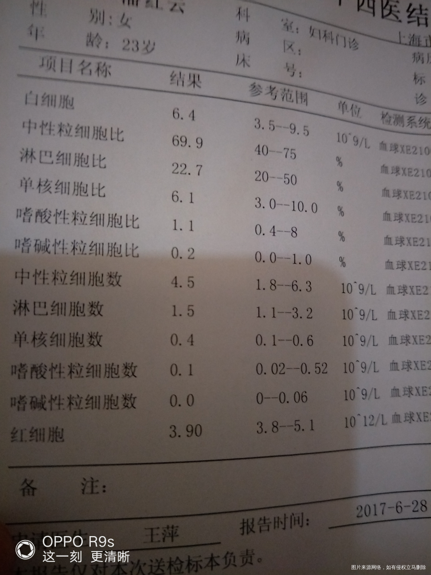 帮我看一下这两个谢谢