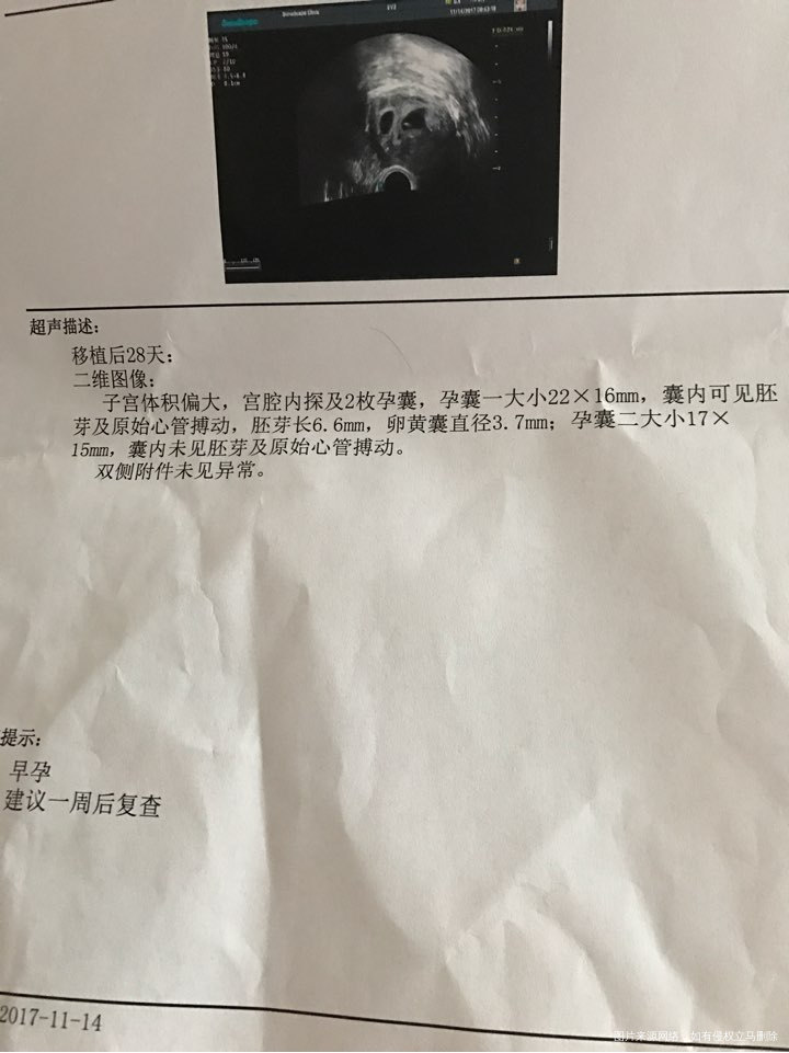 一超归来~好担心小宝