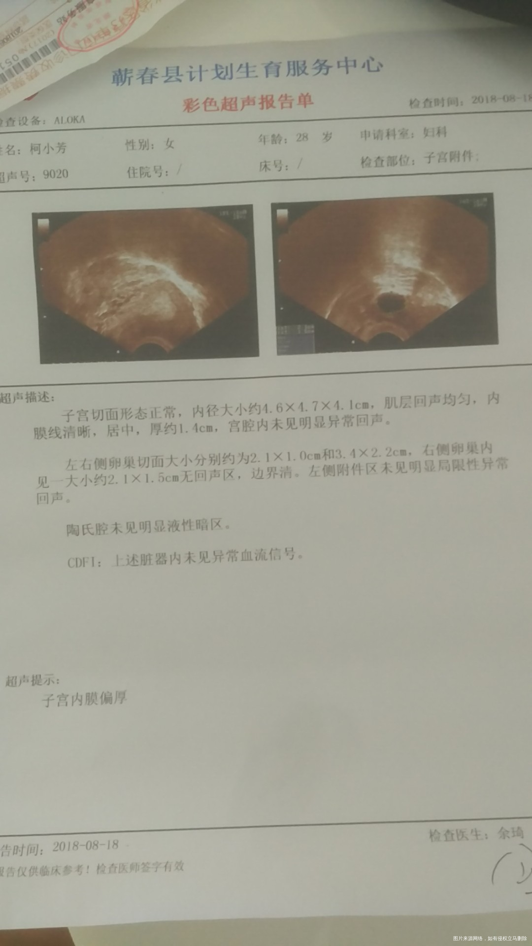 医生帮我看下B超单子和排卵试纸