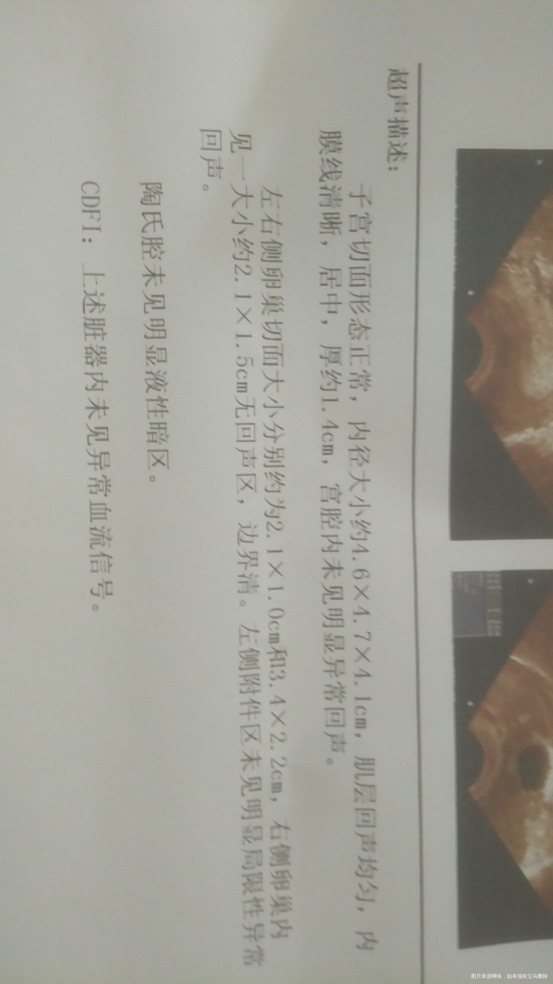 医生帮我看下B超单子和排卵试纸