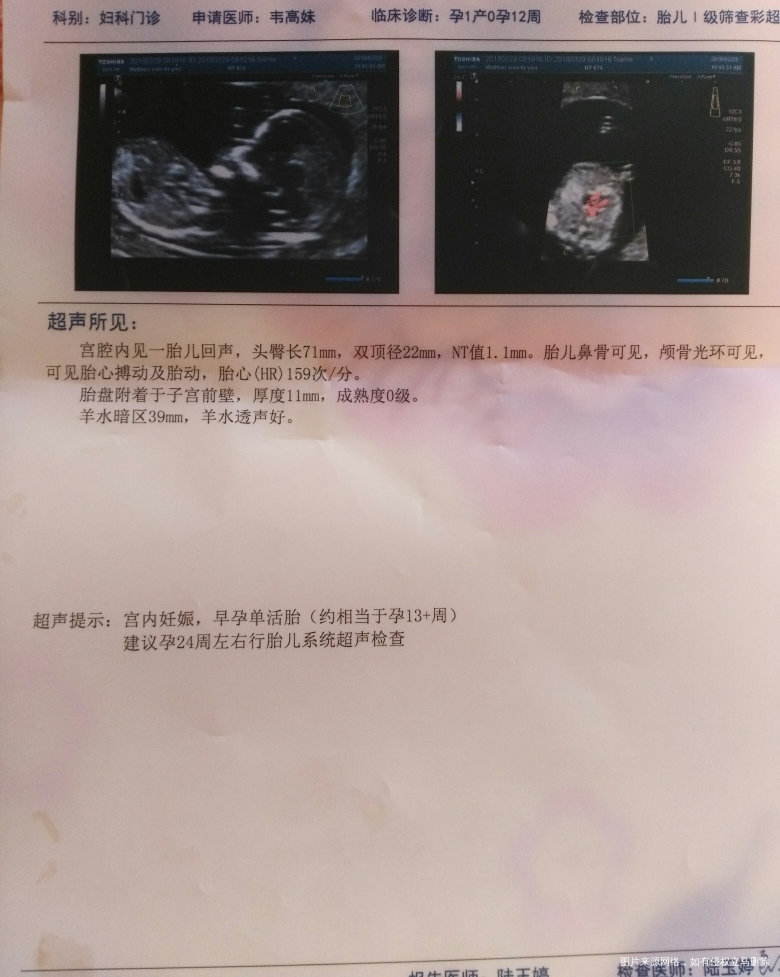 请医生帮我看看,刚照回来的Nt