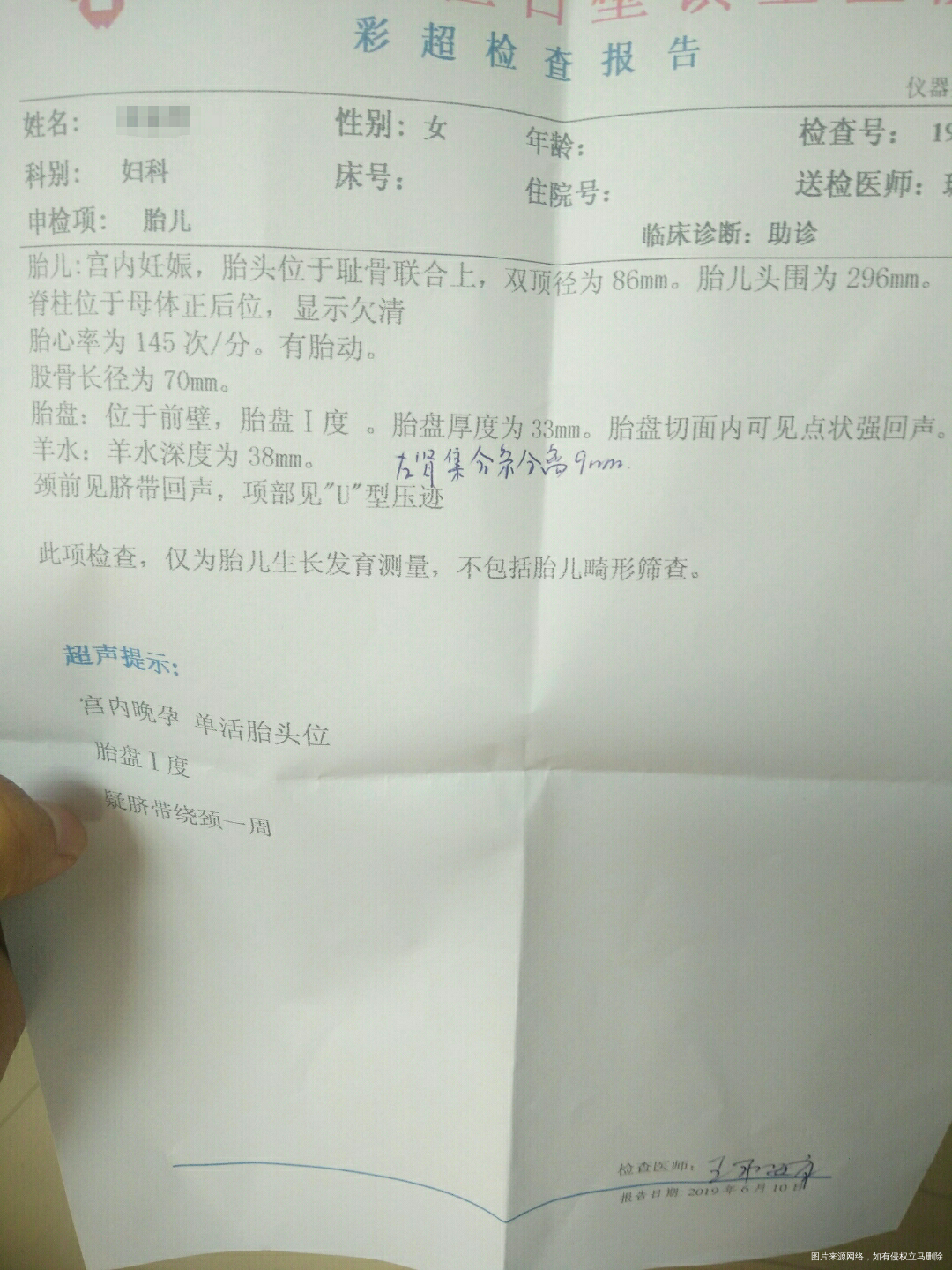 孕37周+5,帮我估算胎儿有多重?