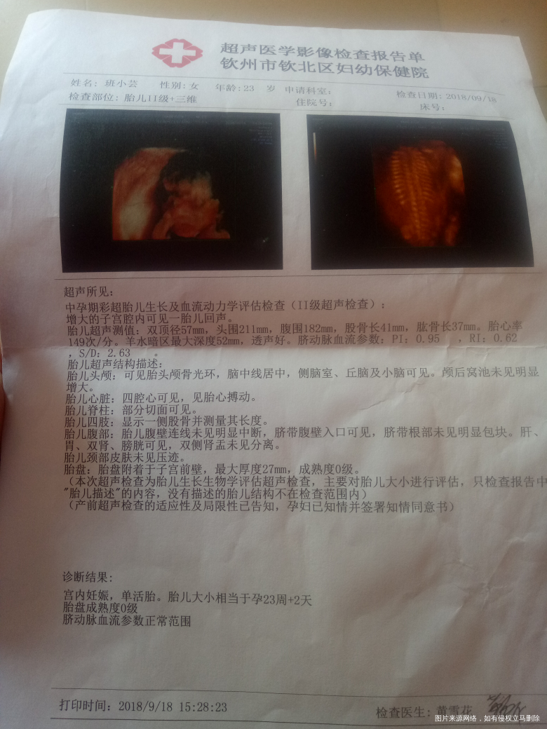 医生,帮我看看这个三维没事吧?
