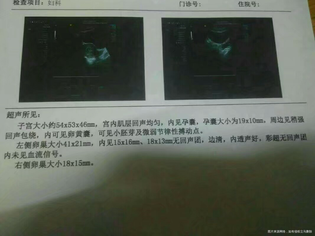 【八一八我做过的检查】婚前检查和同房时间的重要性