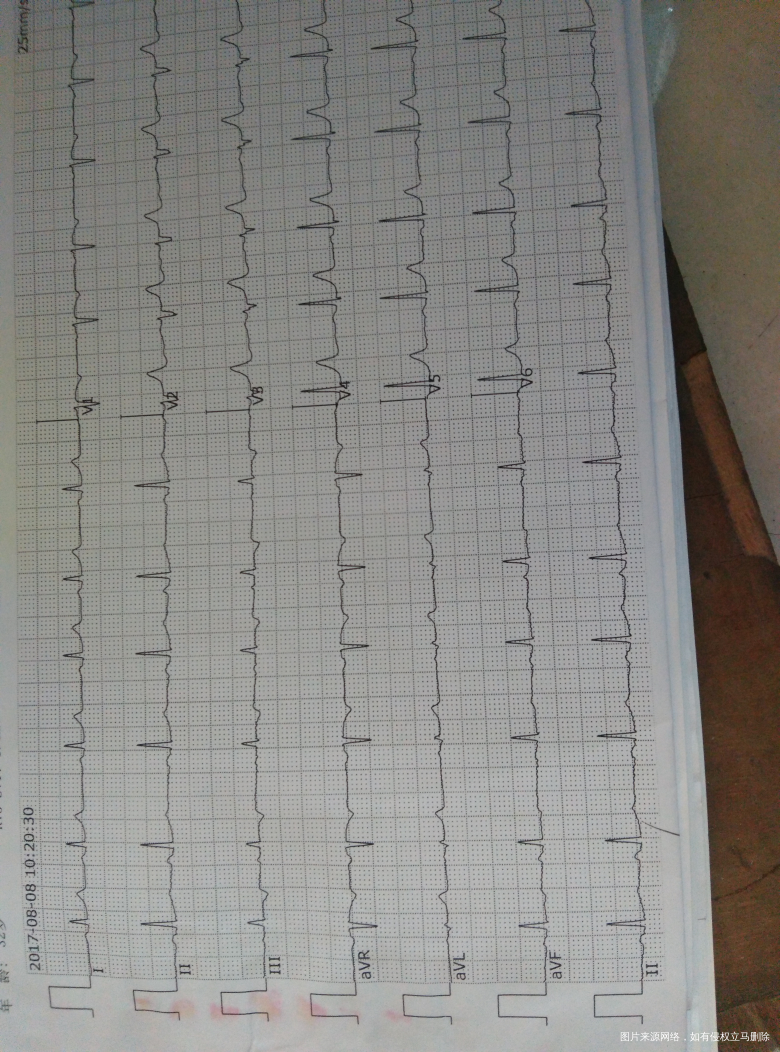 今日产检,有些异常,术医生帮忙解答