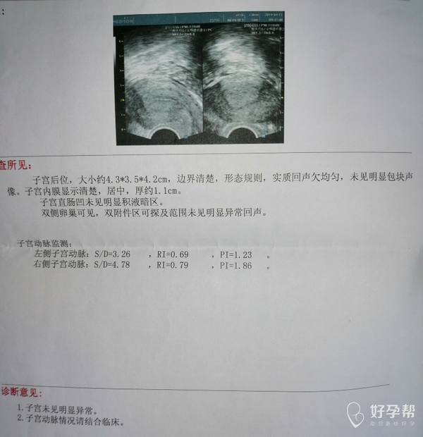 谁会看子宫动脉血流的