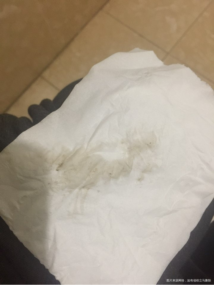 移植囊胚第六天早上起来有褐色的东西,是月经吗?