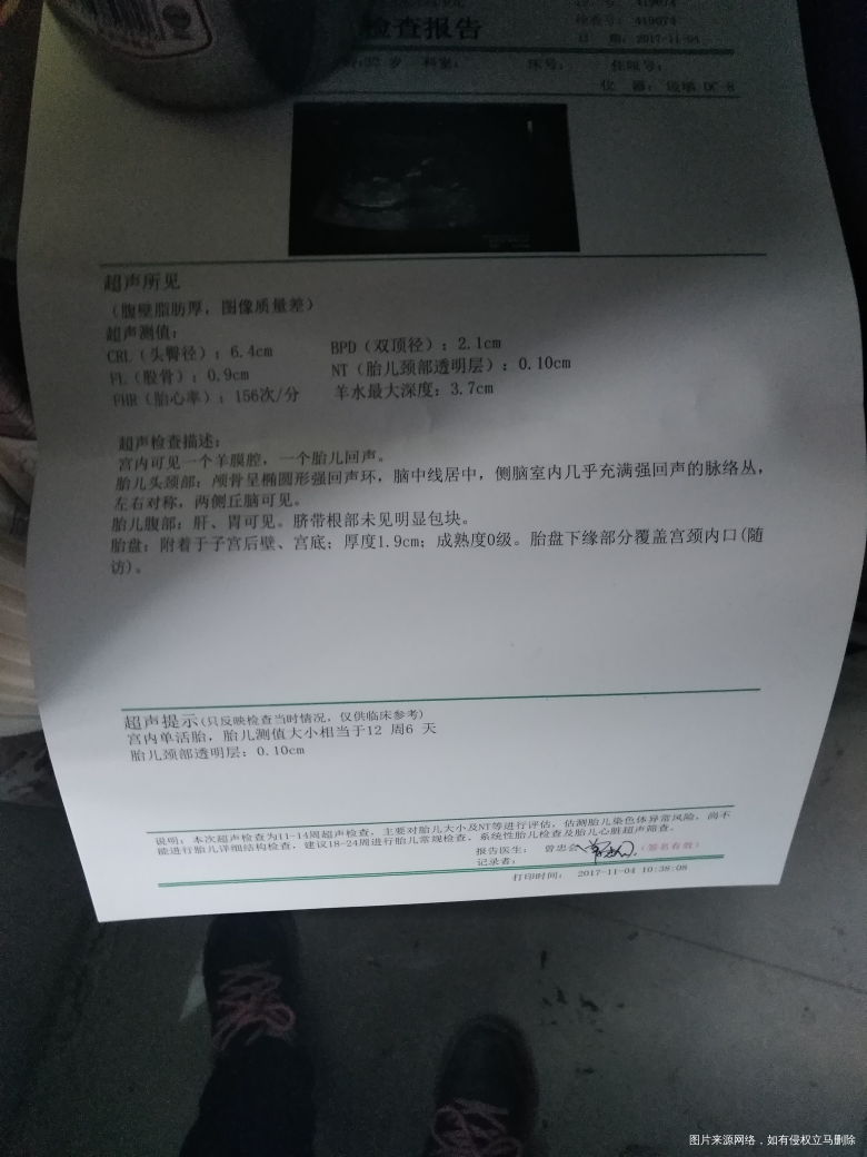 怀孕三个月零几天腰疼,请问是怎么回事