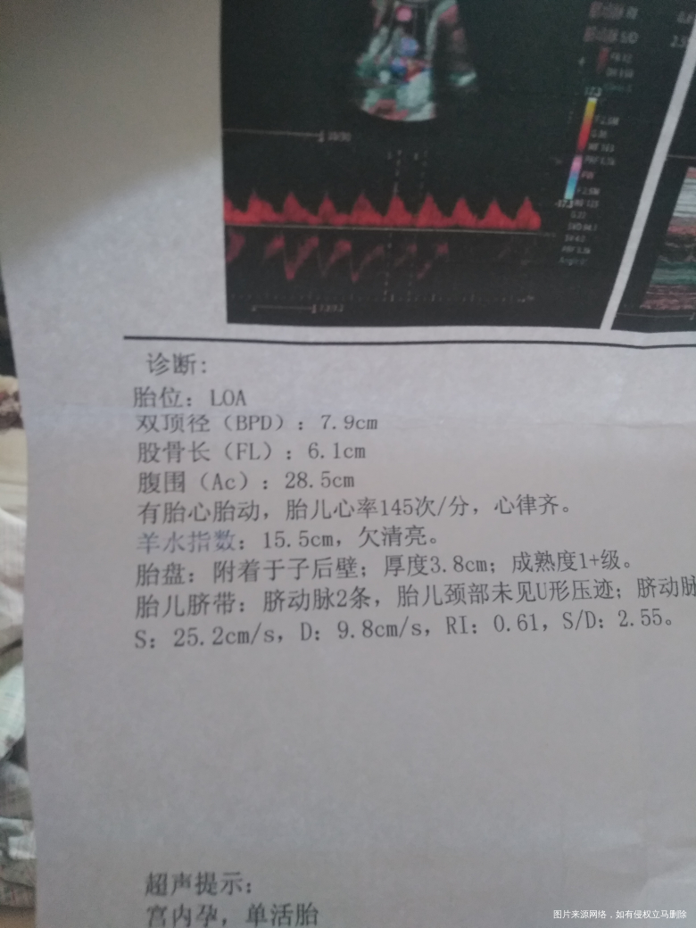 请问医生怀孕32+胎盘这样是正常不,可以下蹬不