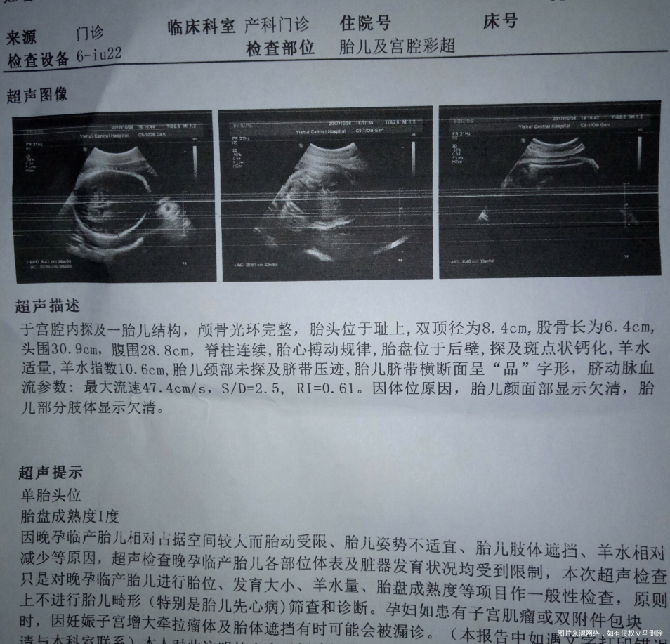 能看出来小孩大概有多沉吗?