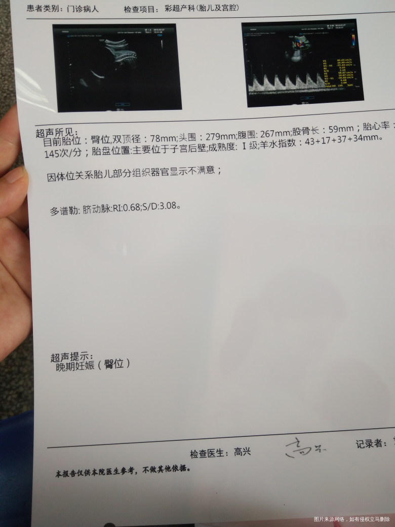 医生B超单请帮忙看一下