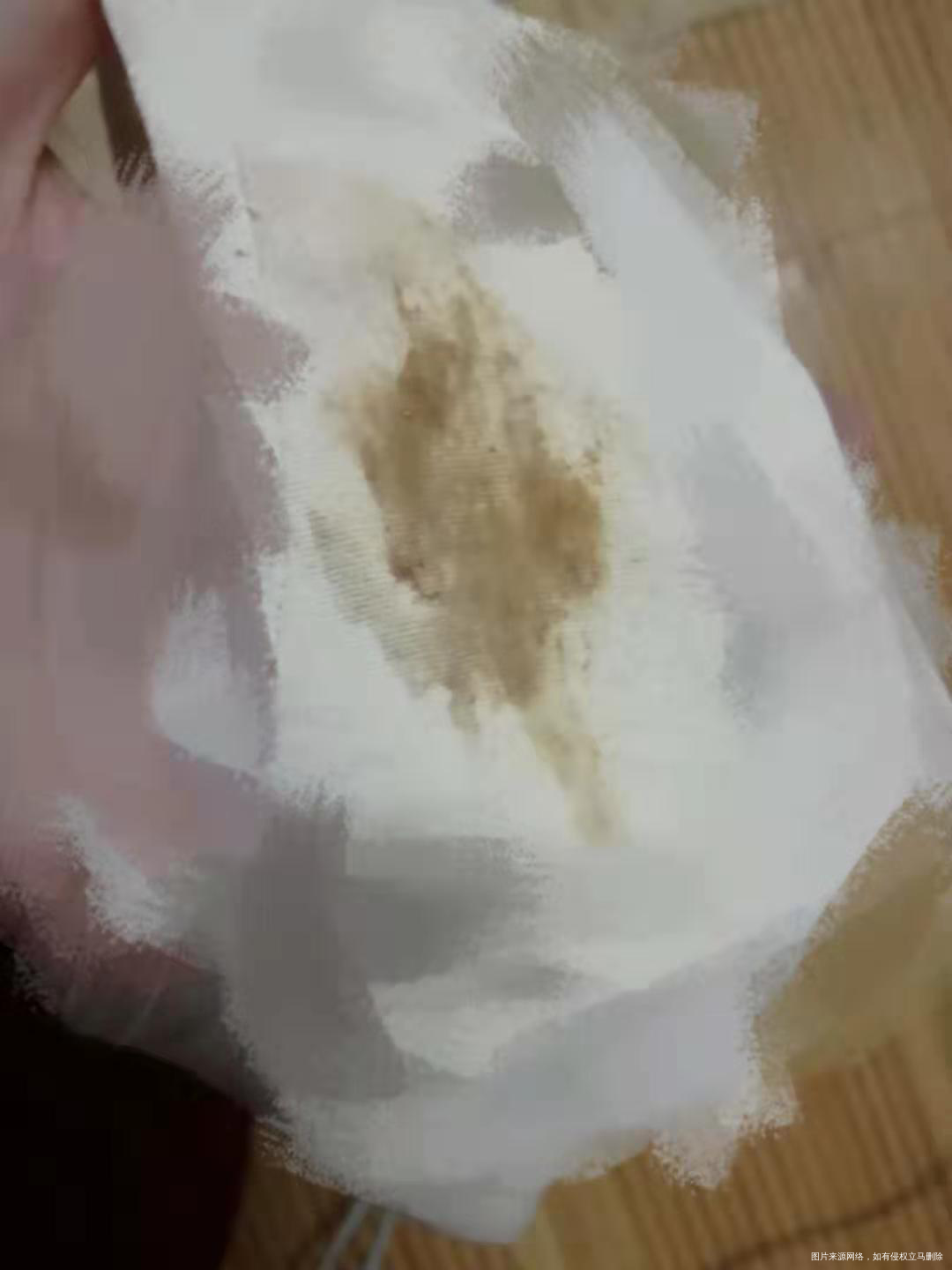 没征兆,突然有褐色的分泌物