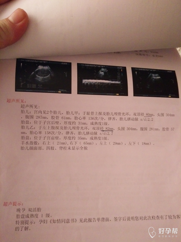 这是33周的b超单 想问一下胎儿现在大概多少斤左右符不符合孕周 羊水