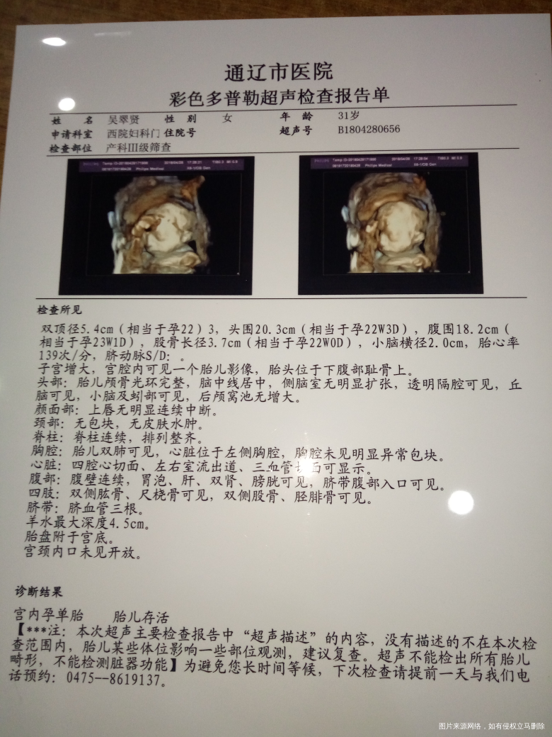 医生帮我看看思维单子!