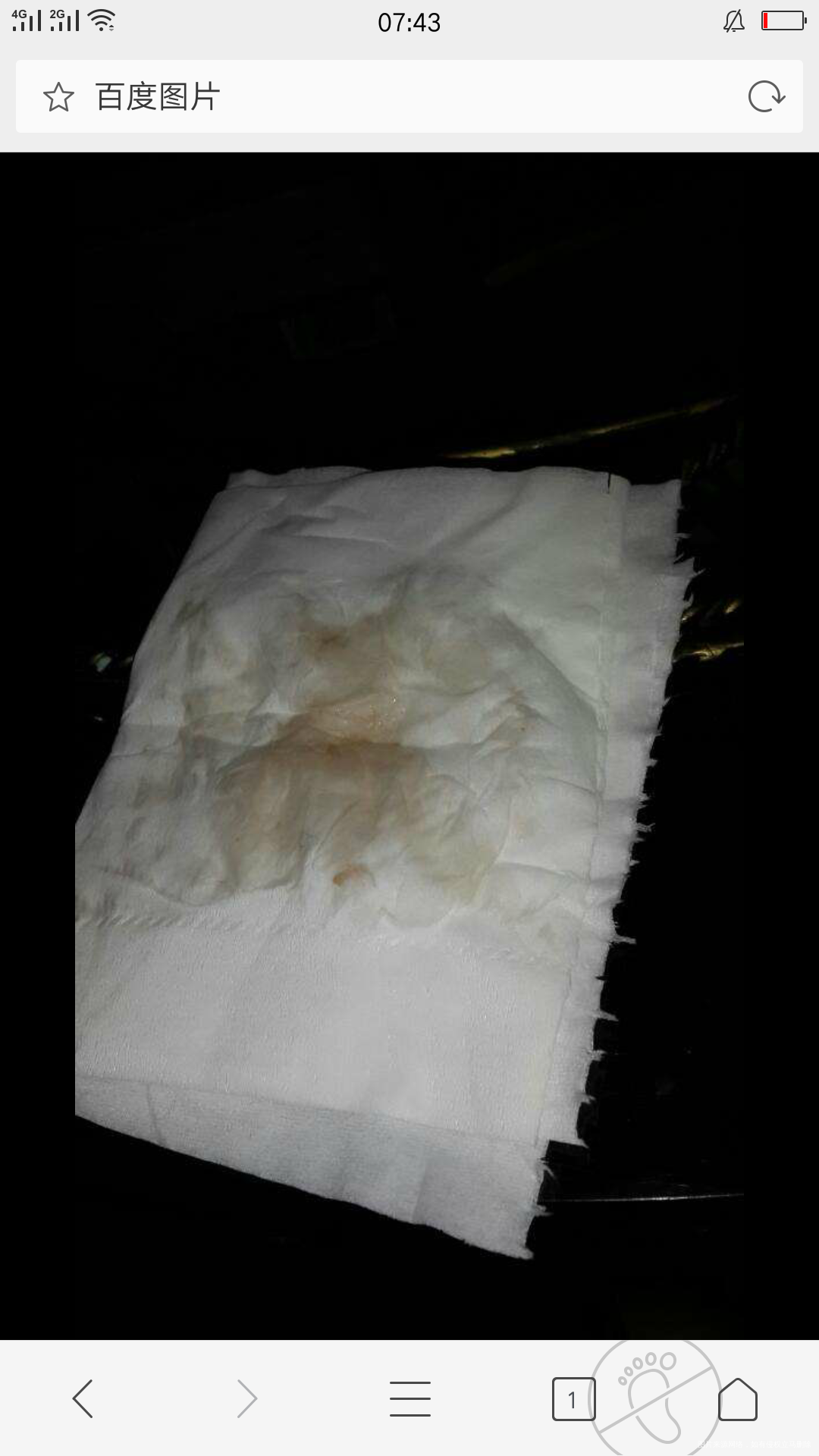 是着床出血还是先兆性流产?