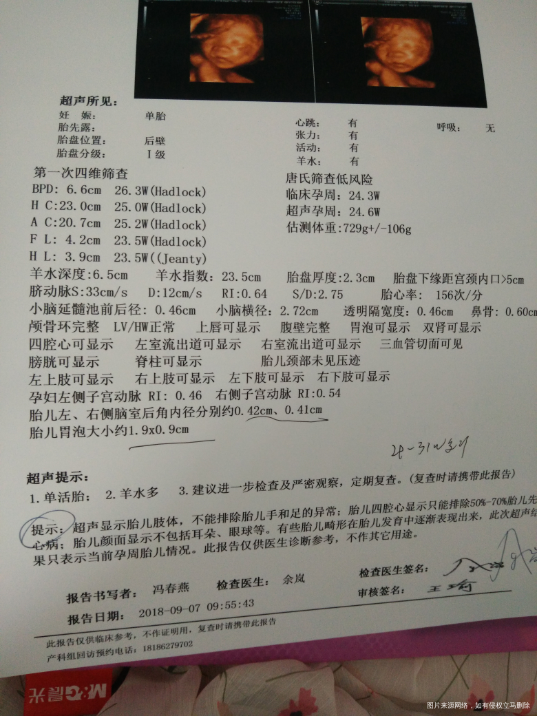 求助医生,帮忙看下四维单子