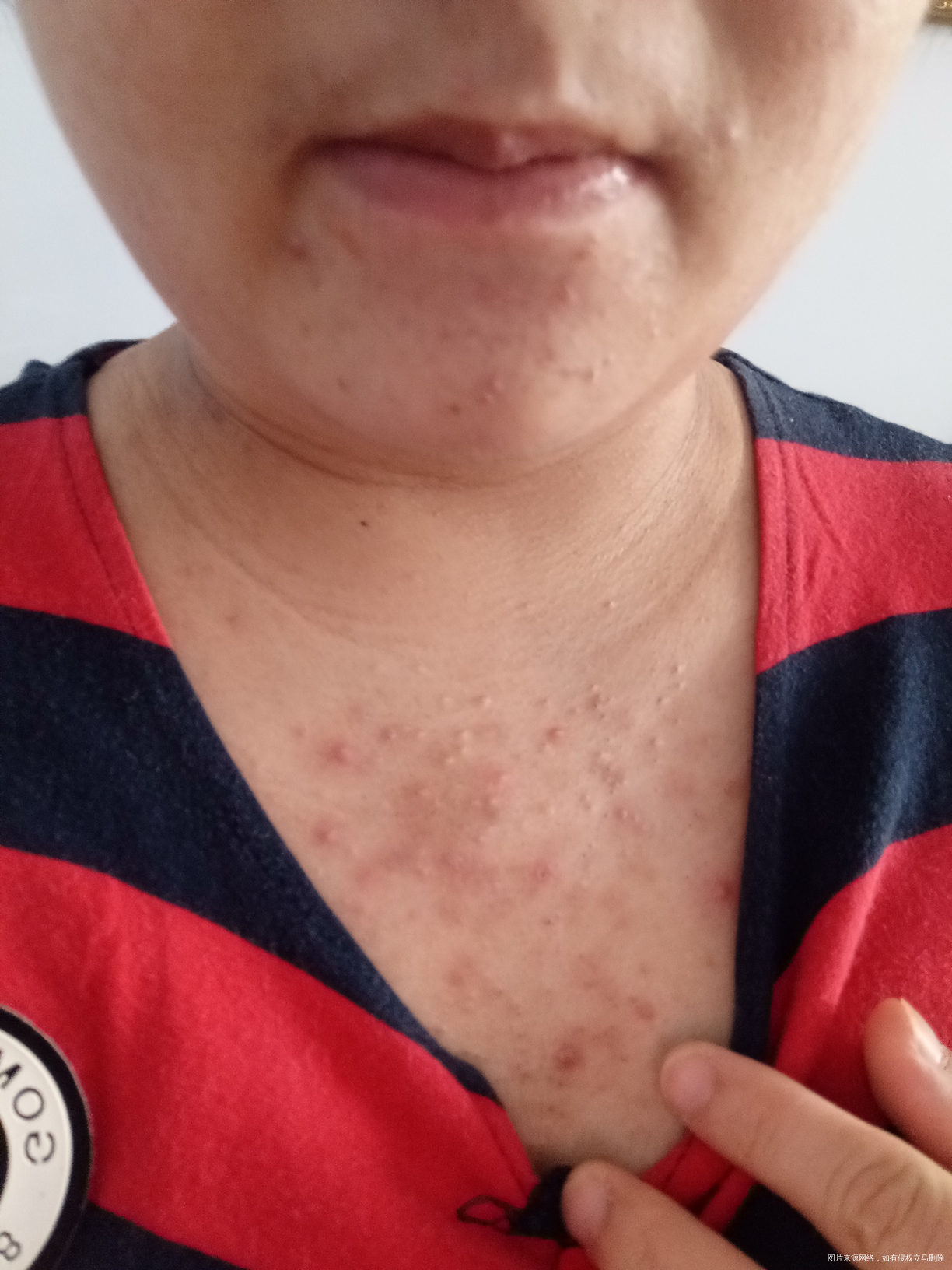 请医生看看这是胎毒吗?