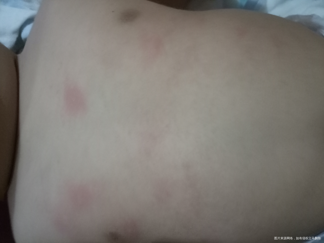宝宝身上是怎么回事啊 也没起泡泡 也没大疙瘩就是红有一点点小豆一样
