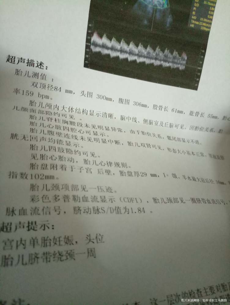 33周加4,今天刚做的b超