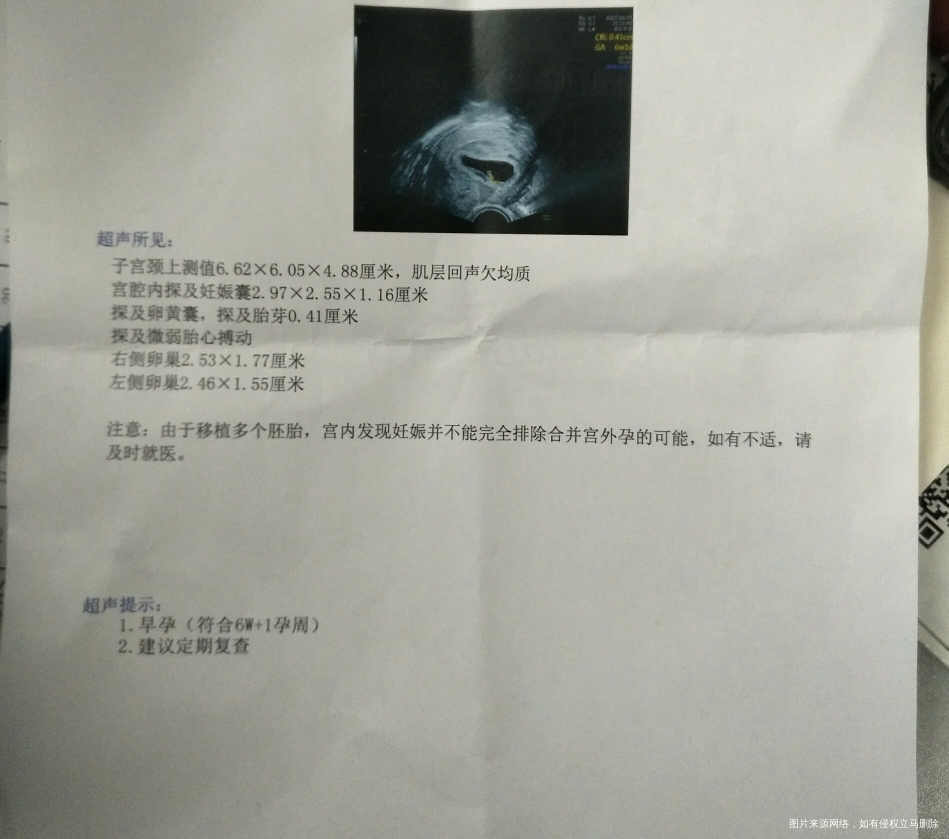 已经移植第31天了,胎心薄弱,好担心。