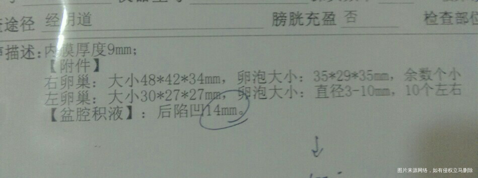 有医生吗?帮我看看这月能受孕吗?