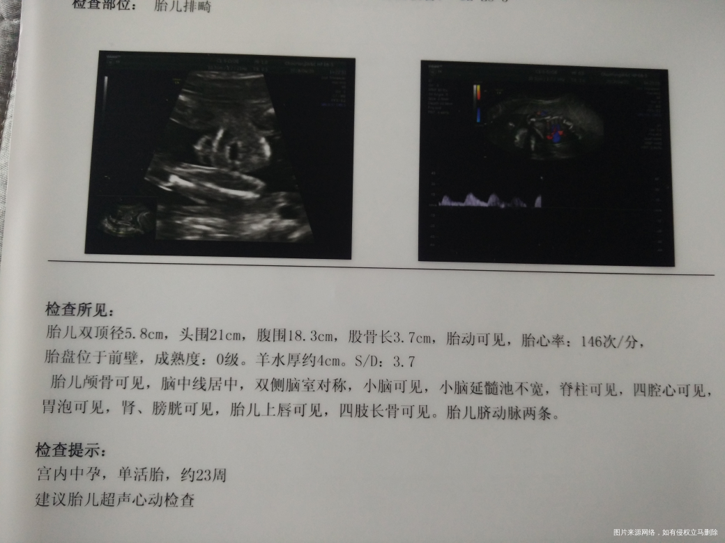 麻烦医生帮我看下排畸b超