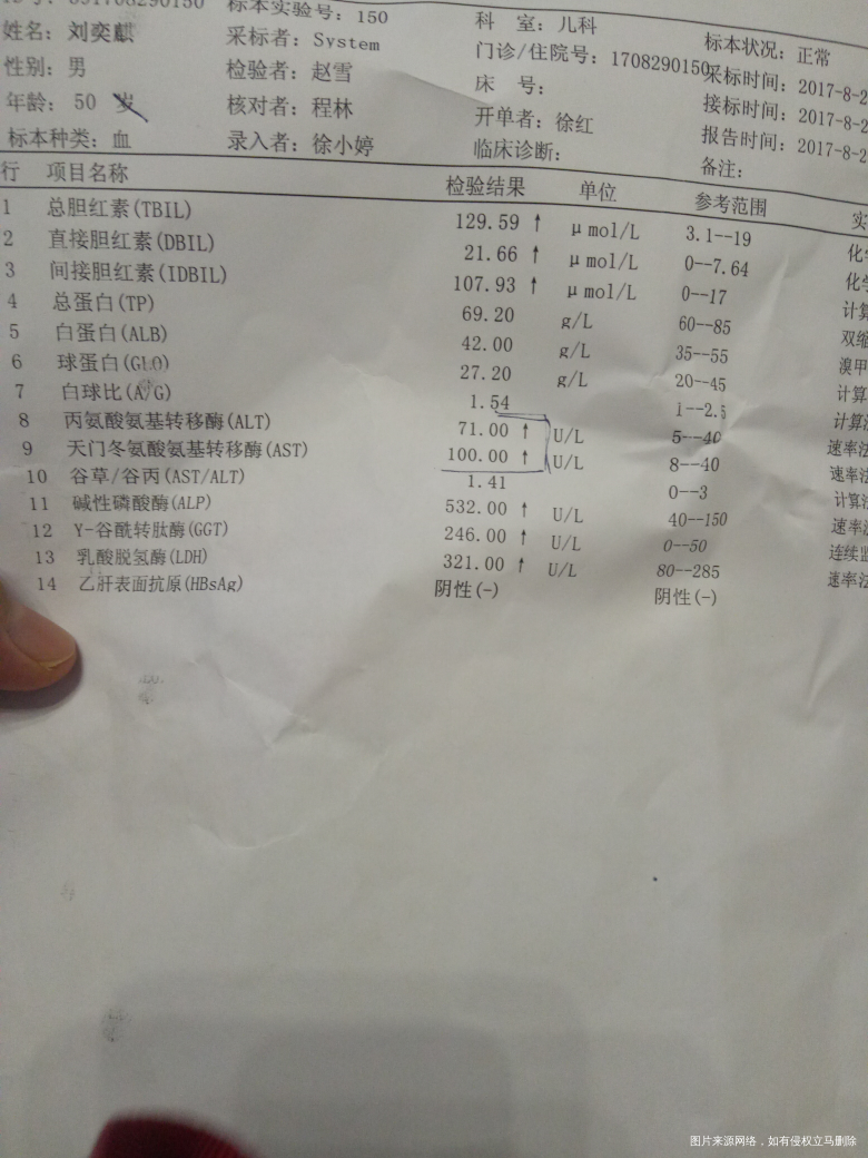 医生,我家宝宝快五十天了,白眼球上面有点黄就去?