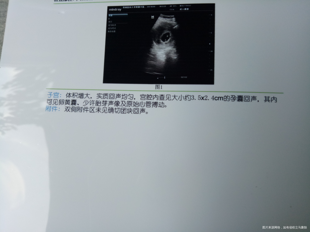 孕七周,今天去医院做了彩超,麻烦医生看一哈结果。