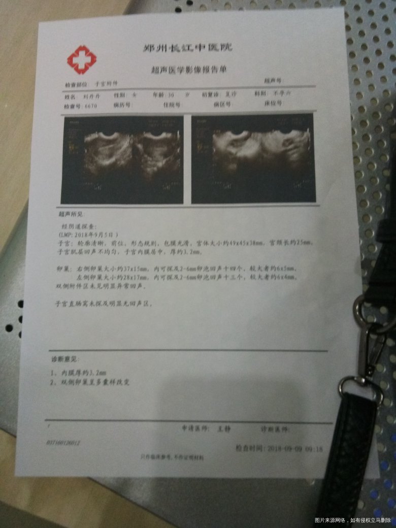 求医生,多囊,月经第5天彩超,