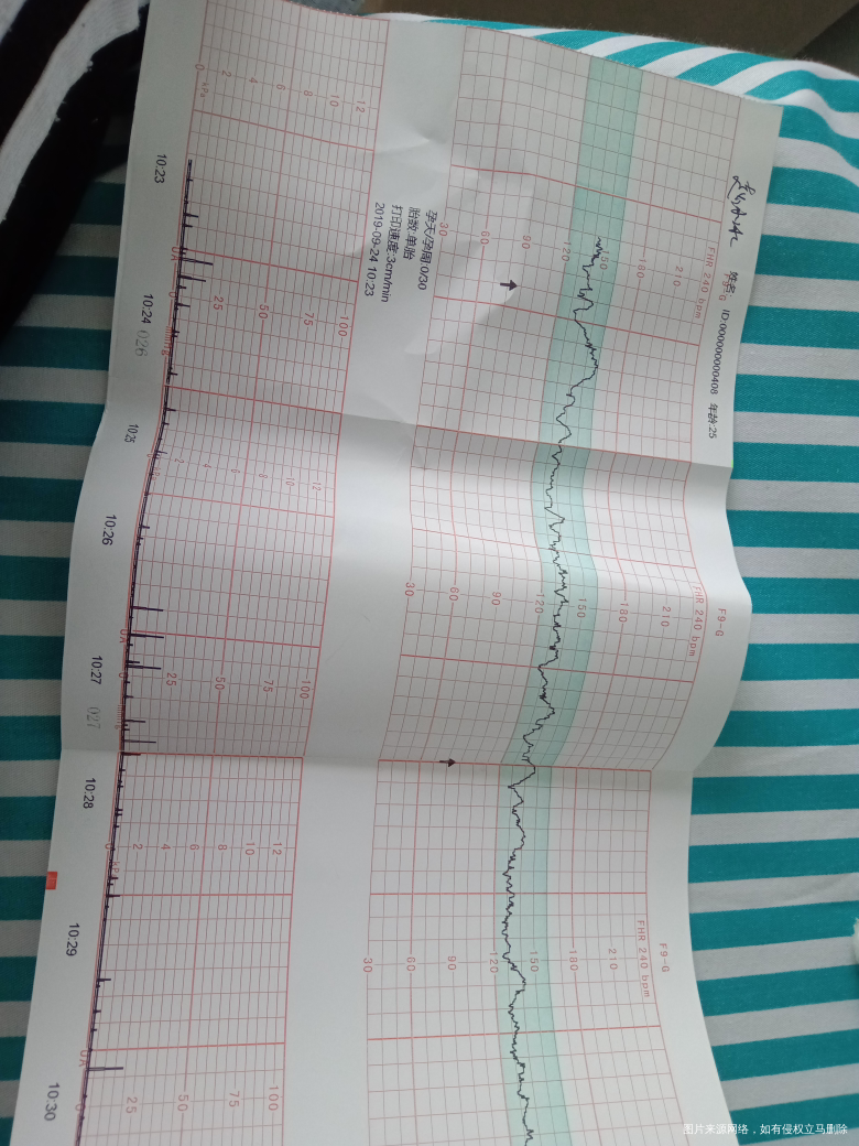 39周胎心监护才6分