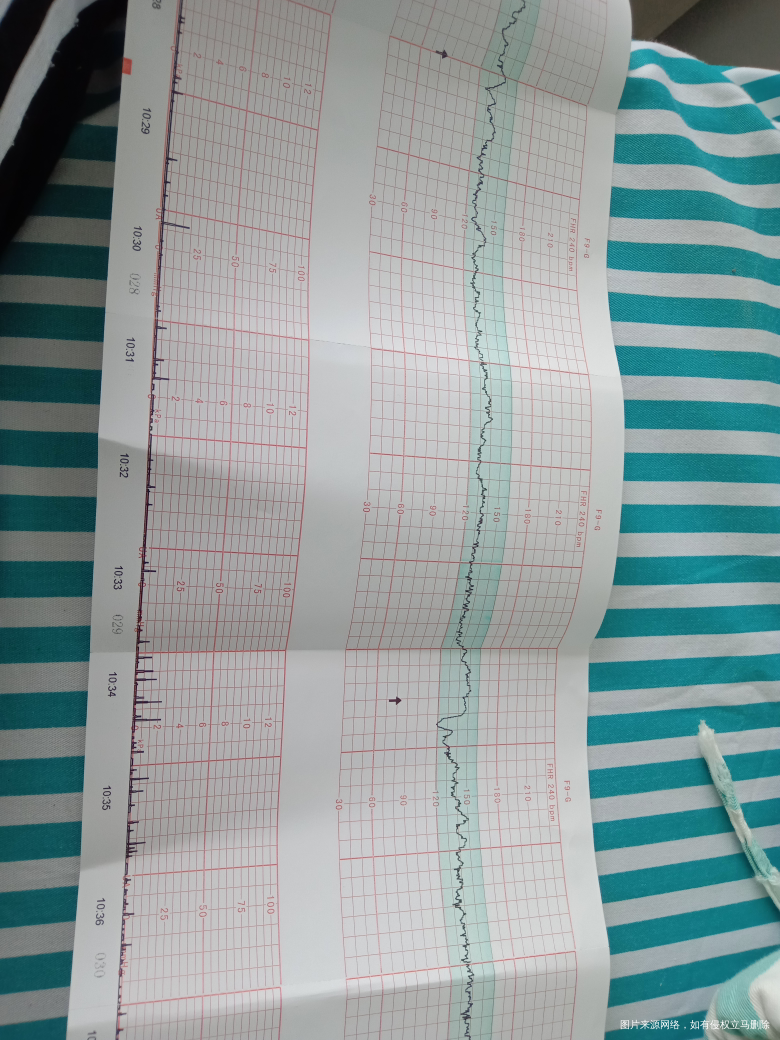 39周胎心监护才6分