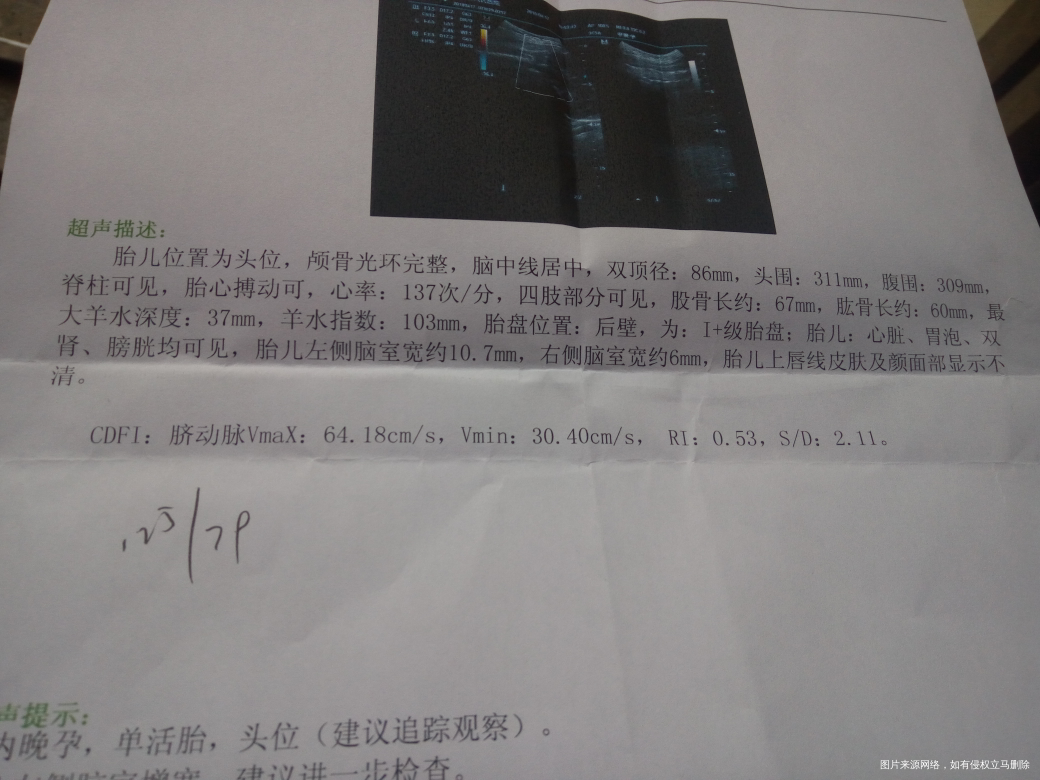 帮忙看下检查单,看看宝宝偏小吗?