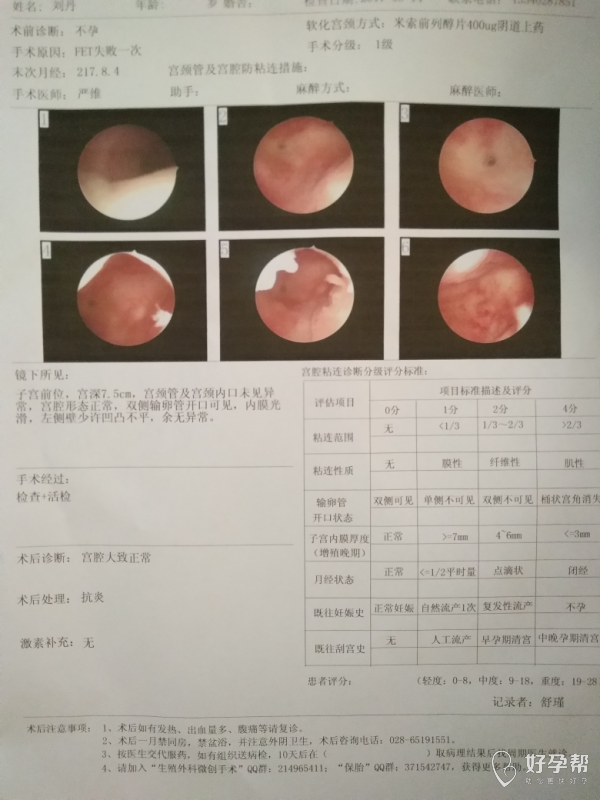 做了宫腔镜希望下次能好孕