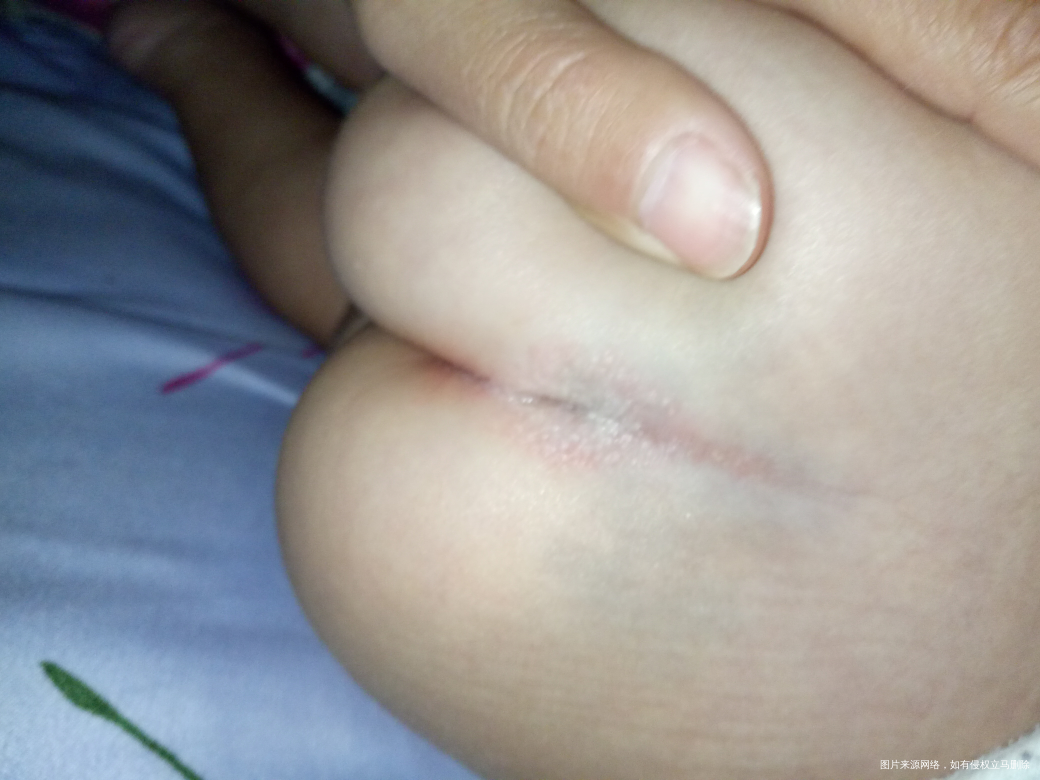 有宝妈知道宝宝屁股长的是什么吗