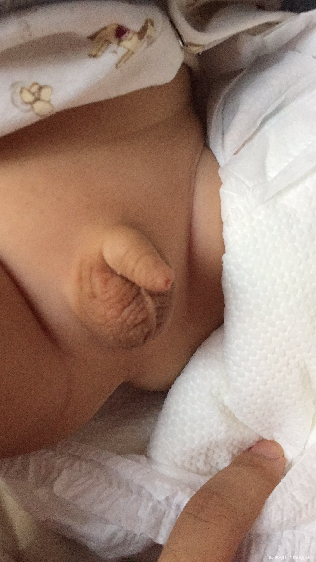 宝宝小鸡鸡一片片红的,怎么回事啊?急!