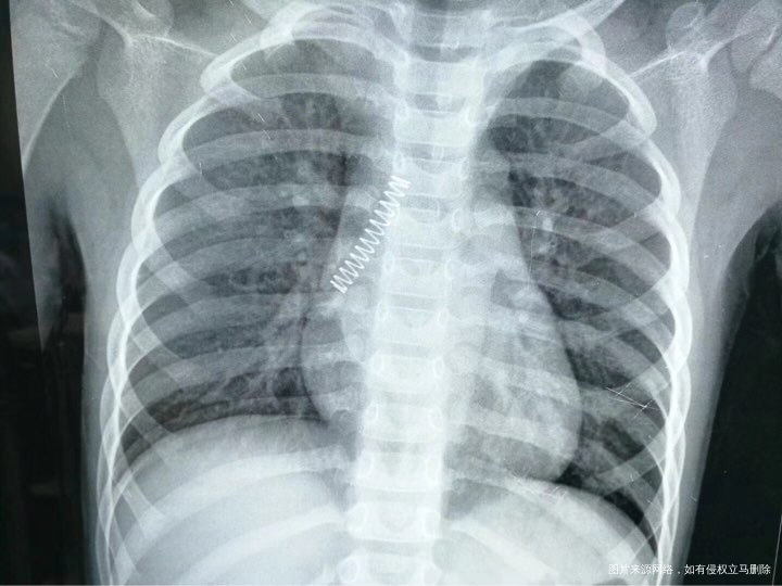 熊孩子真的要看好,电视看多了学吓死人