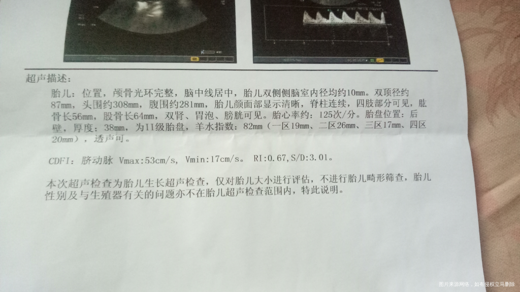 35周加4胎儿双侧侧脑后角均分别为10mm宝宝还能要吗?