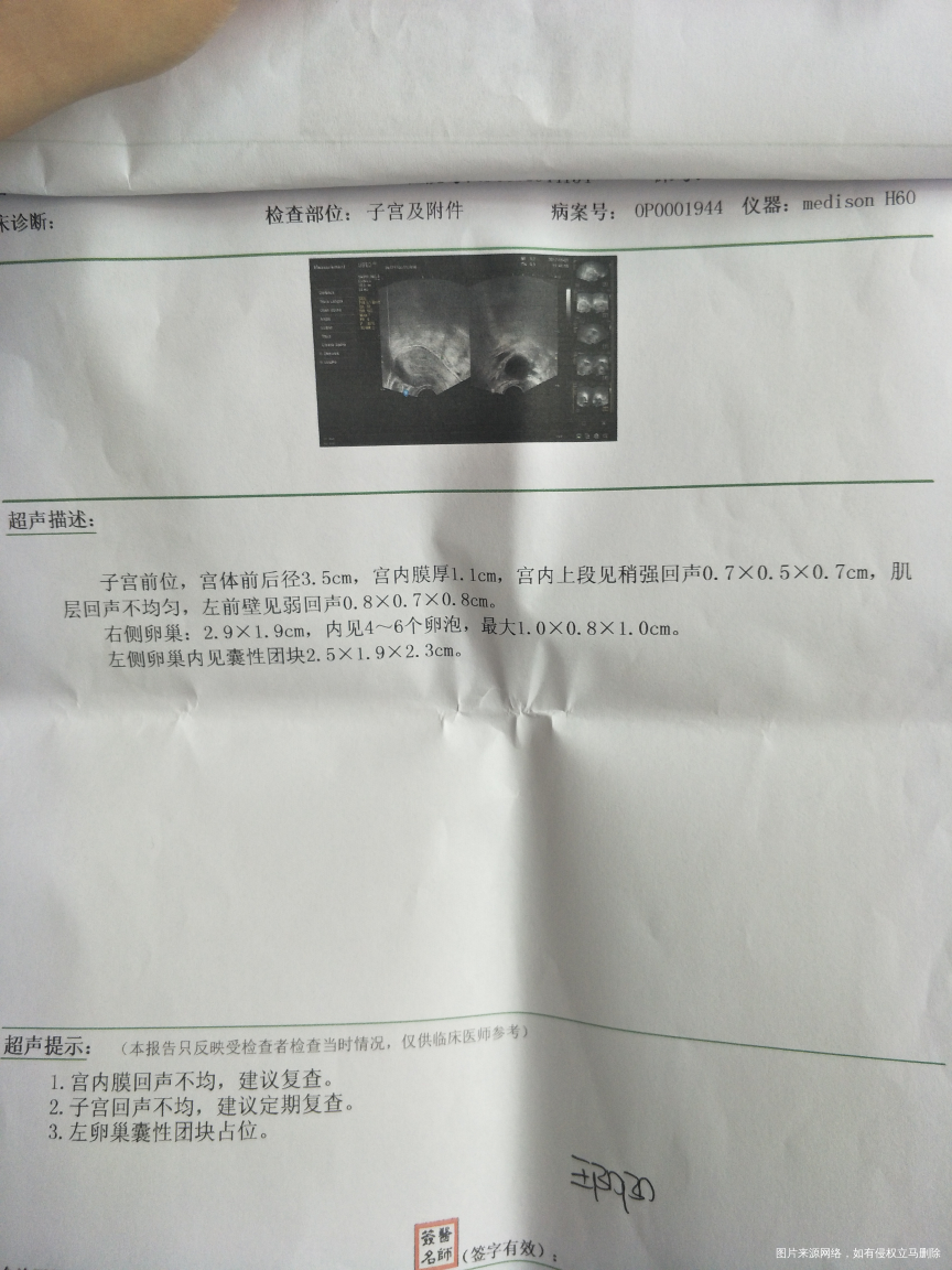 本次排卵期最后一次监测卵泡,成熟卵泡长得过大,是不是没戏了?