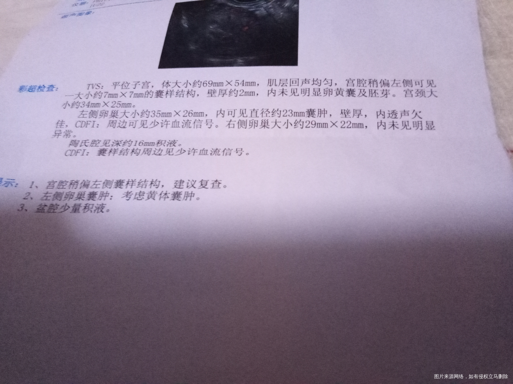 多囊促排卵的检查看不到孕囊是怎么回事?