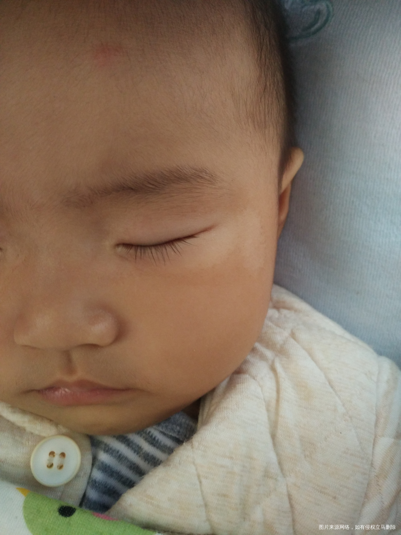 求助:宝宝长湿疹,凑字