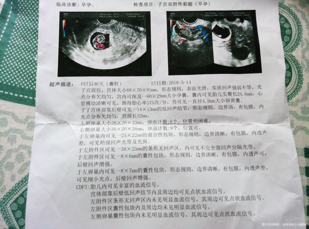 孕9周+4,昨晚流淡淡的鲜红色的血,透过短裤都漏到外裤了